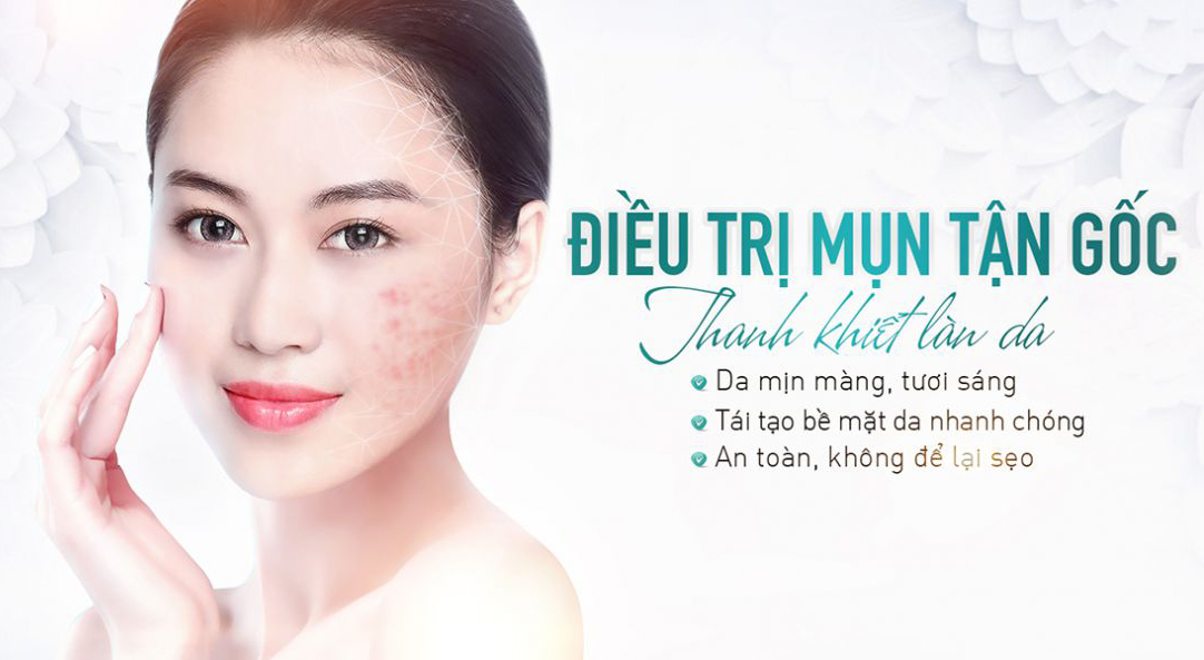 Dịch Vụ Điều Trị Mụn Bằng Đông Y